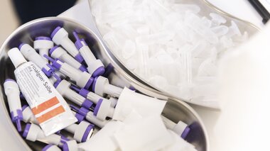 Sportmedizin Laktatmessung beim Leistungstest | © adidas Infinite Trails/Marktl Photography